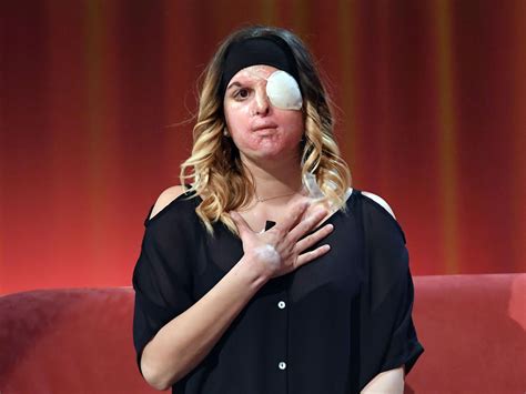 La sua tremenda esperienza è balzata agli onori di cronaca e in. Gessica Notaro: Acid attack victim and former Miss Italy finalist returns to work after horrific ...