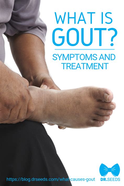 What Meds Do You Take For Gout