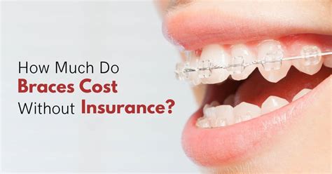How Much Do Braces Cost Without Insurance