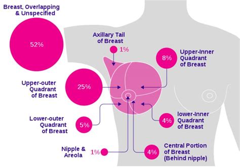 Breast Cancer Types Symptoms Stages And Treatment Of Breast Cancer