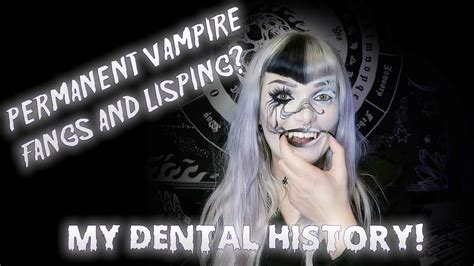 The Story Behind My Permanent Vampire Fangs And Lisping Victoria