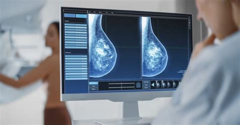 Mammography • Touchstone Medical Imaging
