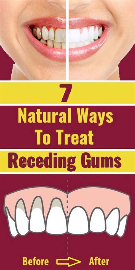 How Can I Treat My Dogs Gum Disease At Home Home And Garden Reference