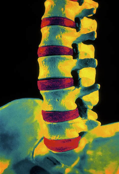 Coloured 3 D Ct Scan Of Lower Spine Photograph By Gjlpscience Photo