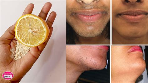 Remove Unwanted Hair Permanently At Home In 3 Days With Lemon Home