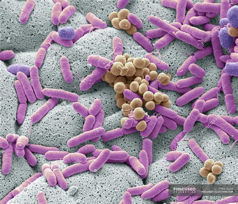 Coloured Scanning Electron Micrograph Of Bacteria Cultured From Used