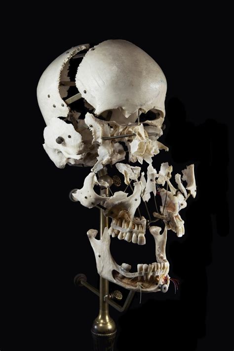 Anatomy Medical 19th Century Ryan Matthew Cohn Osteology