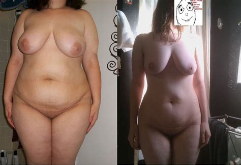 Nude Before And After Weight Loss Pics Porno Quality Pictures Free