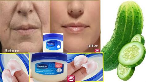Remove Wrinkles From Face Naturally At Home Get Rid Of Deep Mouth