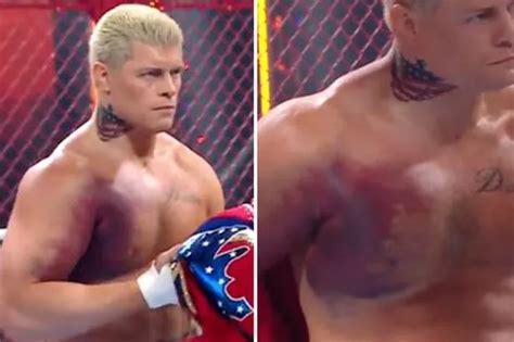 Wwe Star Cody Rhodes Shows Off Sickening Torn Pectoral Tendon At Hell