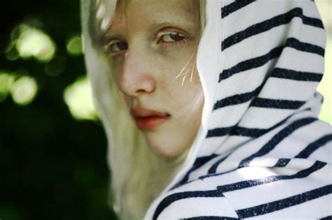Nastya Kiki Zhidkova Albino Model Albino Albinism