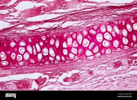 Human Cartilage And Bone Light Micrograph Stock Photo Alamy