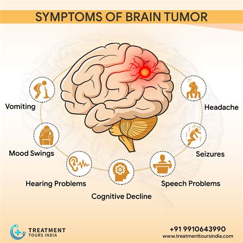 Brain Tumor Visual Symptoms Brainly Drt