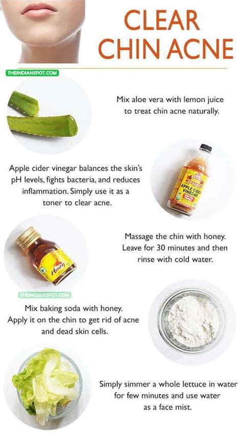 The Right Way Of Dealing With Acne Health And Skin Care Chin Acne