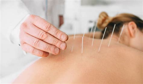 7 Potential Health Benefits Of Acupuncture