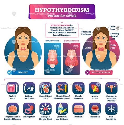 Pin On Health And Medicine Illustrated