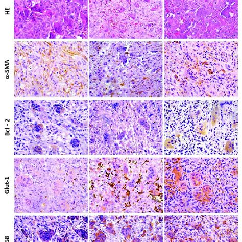 Histological Features And Immunohistochemical Expression Of α Sma
