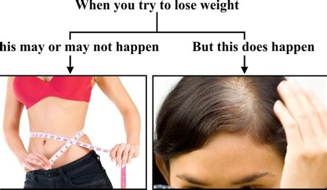 Hair Loss Due To Dietary Deficiency And Weight Loss Dr Health Clinic
