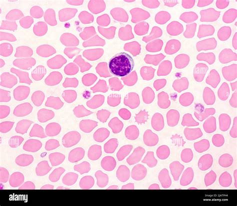 Human Blood Smear With Lymphocyte Light Micrograph Stock Photo Alamy