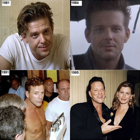 Mickey Rourke Plastic Surgery Before And After Photos Celeblenscom