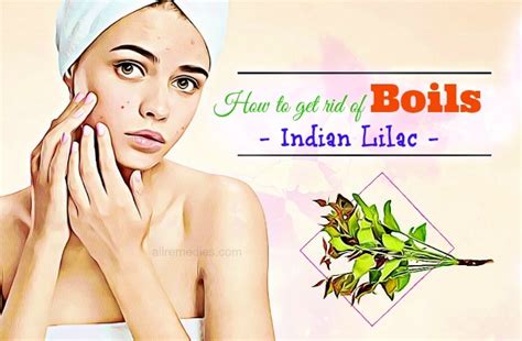 26 Valuable Remedies How To Get Rid Of Boils On Face And Buttocks Fast