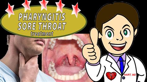 Sore Throat Pharyngitis What Should Do Youtube