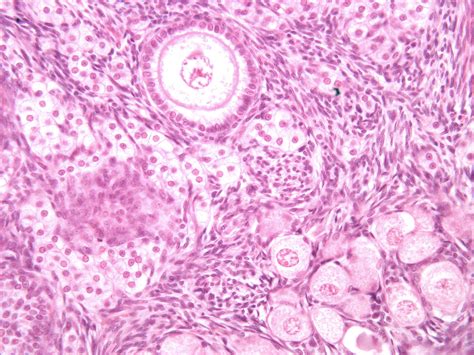 Ovary From Cat 400 X