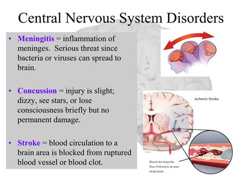 What Is A Nervous System Disorder