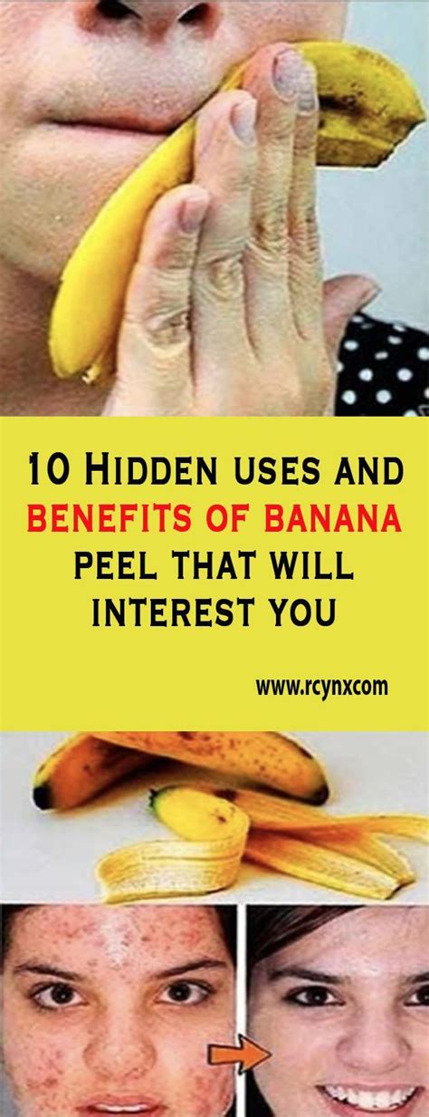 10 Hidden Uses And Benefits Of Banana Peel That Will Interest You