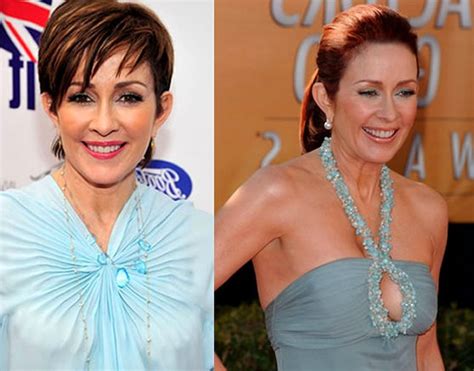 Patricia Heaton Looking Great After Plastic Surgery