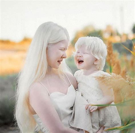 Albino Girl Nude Ass