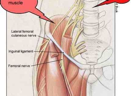 Right Groin Pain Female But With Groin Pain Various Impingement Syndromes In The Hip Should