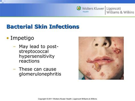 Ppt Chapter 46 Disorders Of Skin Integrity And Function Powerpoint