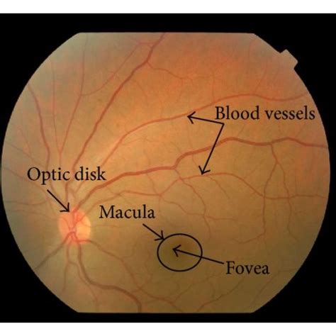 Fundus Image With Normal Features Download Scientific Diagram