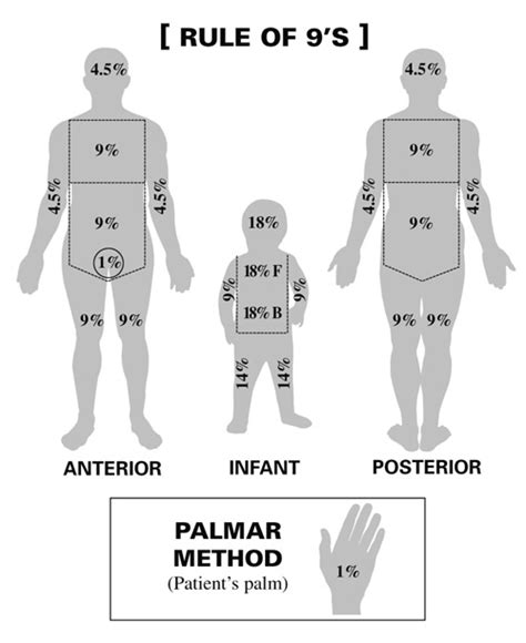 Paediatric Emergency Medicine Minor Burns In Children