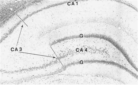 Dorsal Hippocampus From A Control Rat Cai Ca4 Pyramidal Cell
