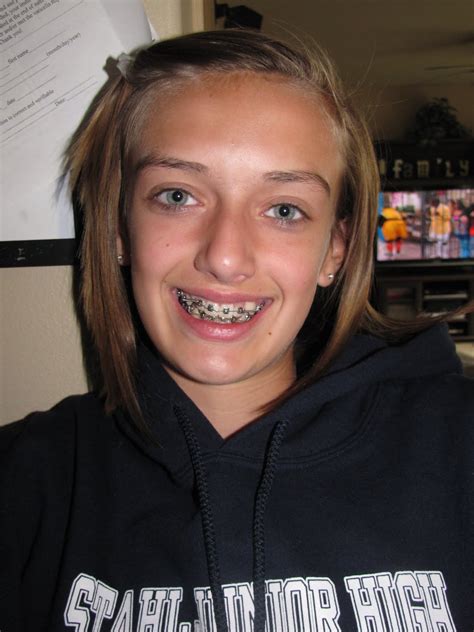 The Elwell Family Blog Kaylee Gets Braces Again