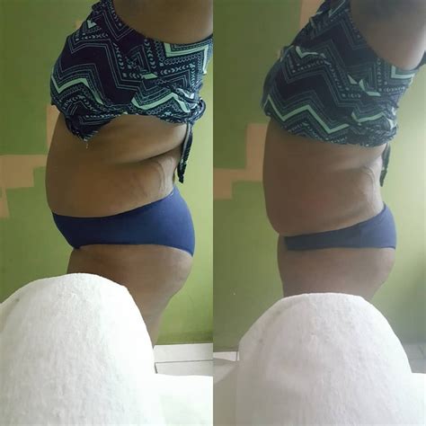 Belly Fat Reduction For Sale In Kingston Kingston St Andrew Healthcare