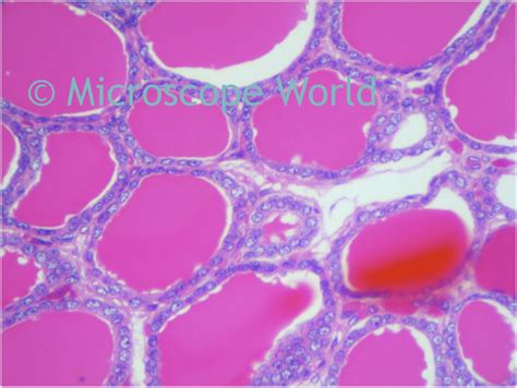Microscope World Blog Tonsils Under The Microscope