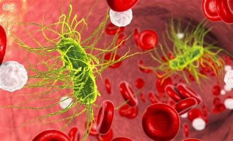 Sepsis oluşumunda birçok enfeksiyon türü rol oynayabilmektedir. Los biomarcadores identifican a pacientes con riesgo de ...