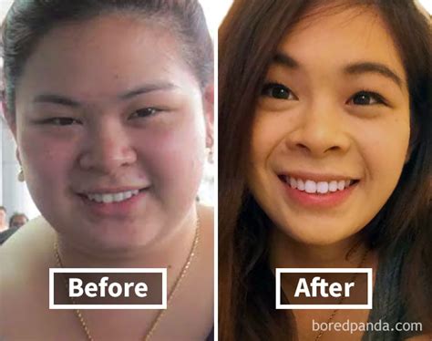 50 Amazing Before And After Pics Reveal How Weight Loss Affects Your Face Bored Panda