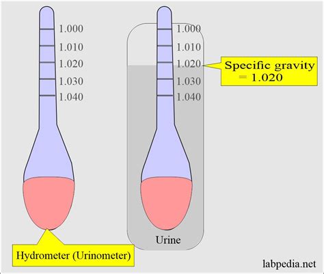 Terms Used To Describe Turbidity Of Urine
