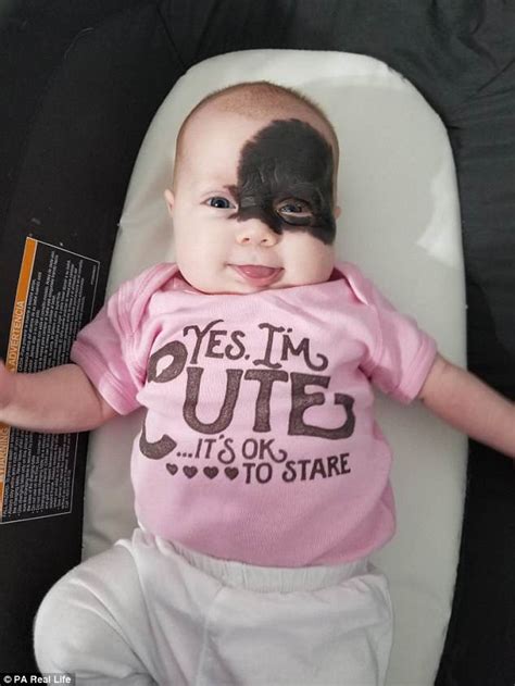Four Month Old Baby Has Been Dubbed A Little Superhero After Being