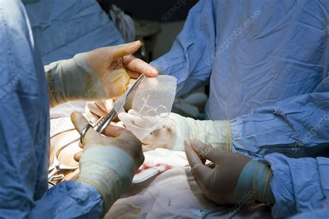 Hernia Operation Stock Image C004 4023 Science Photo Library
