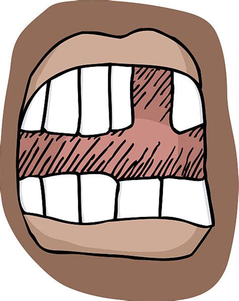 Missing Tooth Smile Clip Art