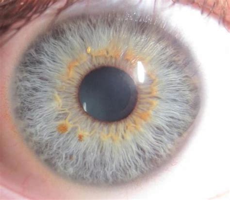 Central Heterochromia Tumblr