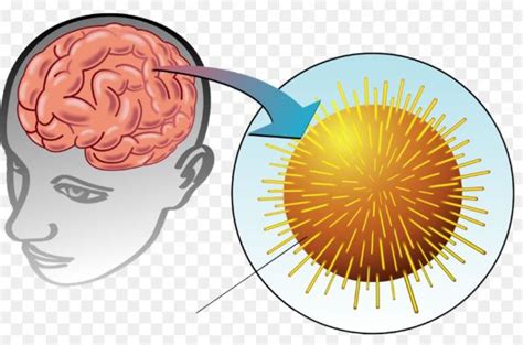 Encephalitis is inflammation of the brain. What Is Encephalitis (Chamki Bukhaar): Causes, Symptoms ...