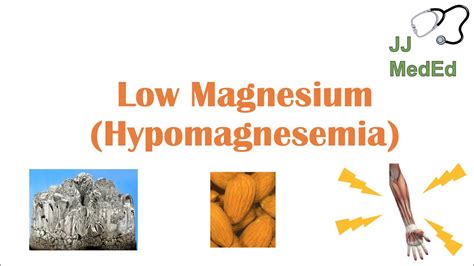 low magnesium hypomagnesemia causes symptoms treatment and role of magnesium dietary
