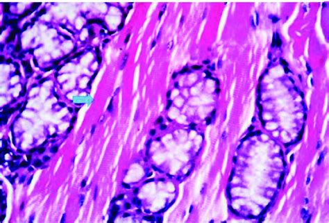 Caudal Part Of Soft Palate Showing The Salivary Gland Separated By