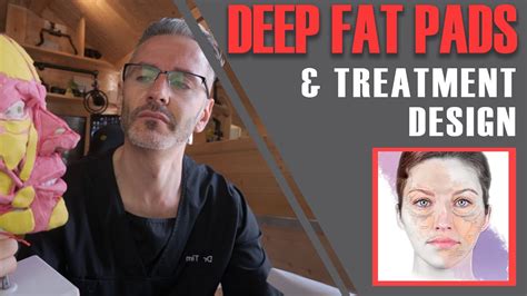 Deep Fat Pads Dr Tim Teaches Upper Middle And Lower Third Fat Pad